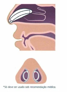Splint Nasal - Image 3